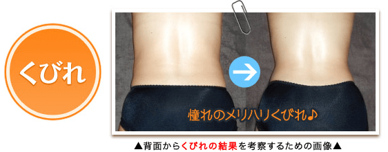 くびれ